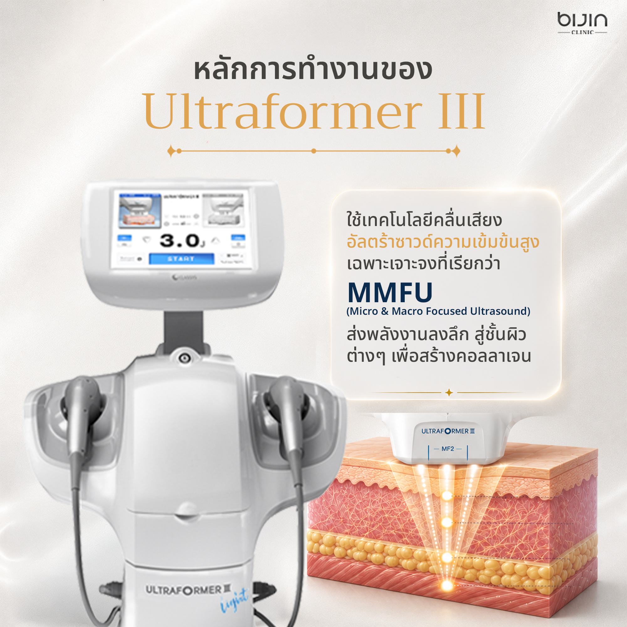 ผลลัพธ์ Ultraformer III ภาพที่ 1